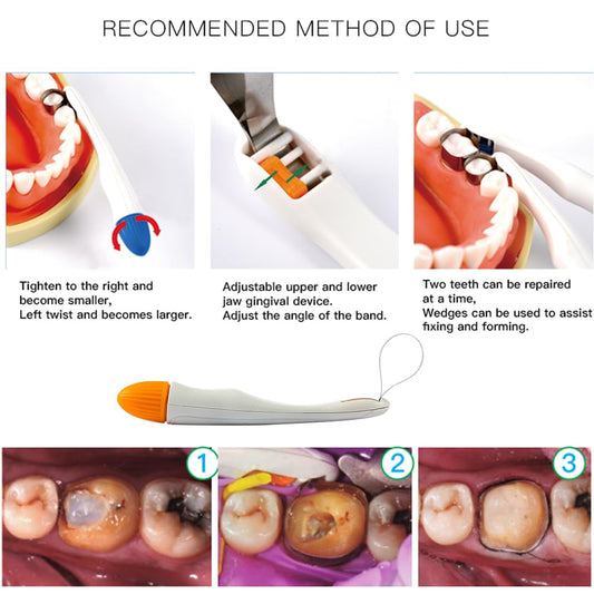 Easyin Smile Matrix Profecto Sectional Matrix Set (50pcs / set)