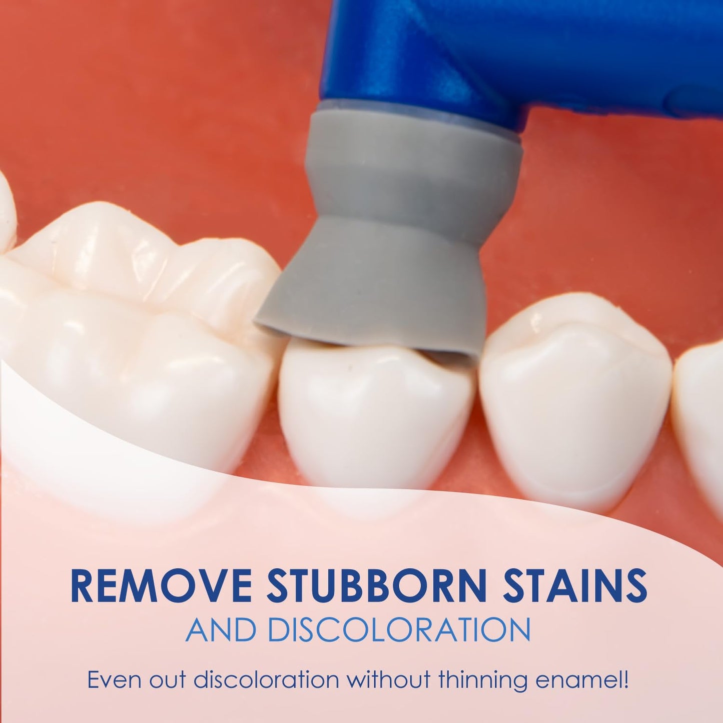 Prophy Angles 100pc/ pk