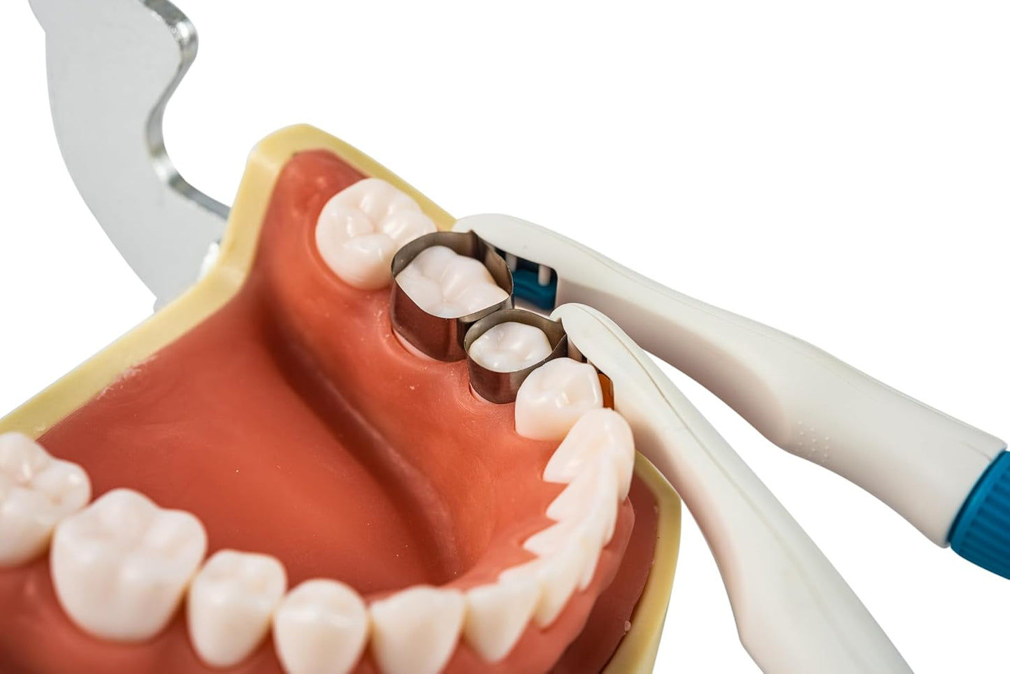 Easyin Smile Matrix Profecto Sectional Matrix Set (50pcs / set)