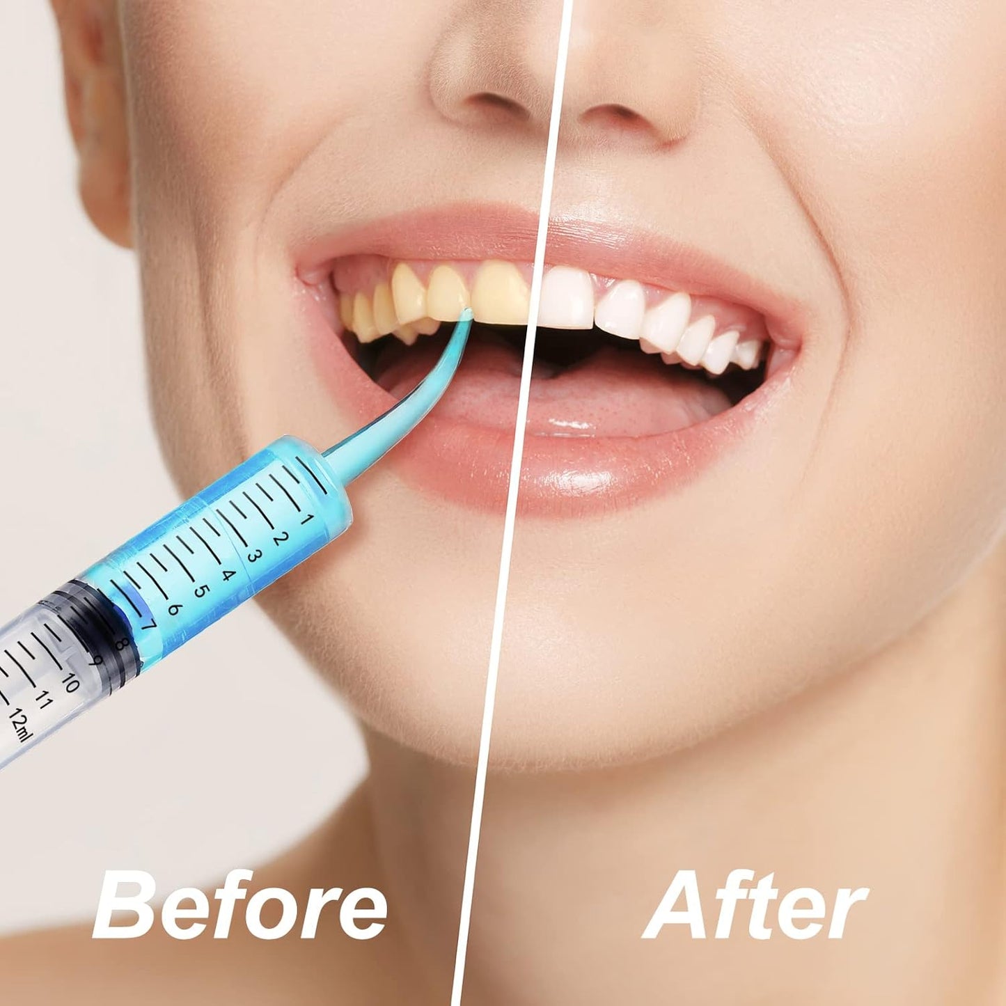 Dental Irrigation Syringe 12cc / 12ml Curved Tip with Scale (pack 50pcs)